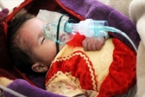 Dünya Sağlık Örgütü: Yemen'de sağlık tesislerinin yarısı hizmet veremiyor