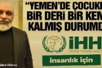 İHH İnsani Yardım Vakfı Genel Başkanı Yıldırım: Yemen'de çocuklar bir deri bir kemik kalmış durumda