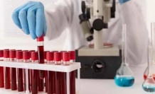 Bilim insanları 50 yıllık gizemi çözdü: Yeni bir kan grubu keşfedildi