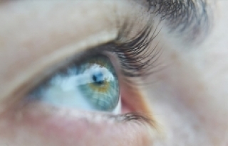 Açık renkli gözlülerde göz kanseri riski daha...