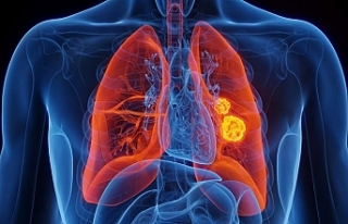 Önlem alınmazsa kanser kaynaklı ölümler 2050’ye...