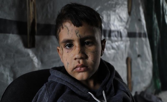 İnsan Hakları İzleme Örgütü'nde istifa krizi: Filistin raporu engellendi